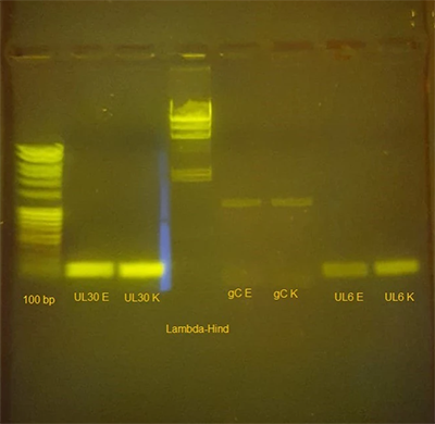 Images/Posts/Post-Content/Gel-Electrophoresis-of-a-colony-PCR_Kilobaser-Post-Visual